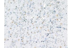 Phospho-MyoD1 (Ser200) Antibody at 1/100 staining Rat brain tissue by IHC-P. (MYOD1 抗体  (pSer200))