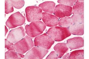 anti-Integrin, alpha 7 (ITGA7) (AA 478-577) antibody