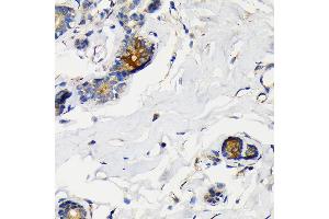 Immunohistochemistry of paraffin-embedded human breast using Mammaglobin A Rabbit mAb (ABIN7270186) at dilution of 1:100 (40x lens). (Mammaglobin A 抗体)