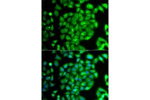 Immunofluorescence analysis of A549 cell using MEOX1 antibody.
