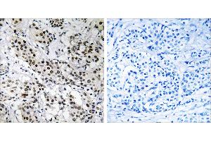 Peptide - + (APBB2 抗体)