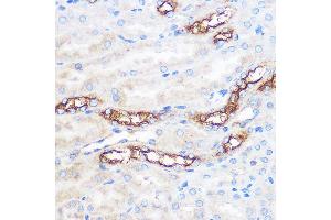 Immunohistochemistry of paraffin-embedded Mouse kidney using WWC2 Rabbit pAb (ABIN7271389) at dilution of 1:100 (40x lens). (WWC2 抗体)