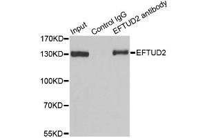 Immunoprecipitation analysis of 100ug extracts of 293T cells using 3ug EFTUD2 antibody. (EFTUD2 抗体)