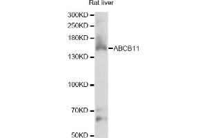 Western blot analysis of extracts of rat liver, using ABCB11 antibody (ABIN6291730) at 1:1000 dilution. (ABCB11 抗体)