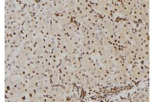ABIN6267382 at 1/100 staining Human liver tissue by IHC-P. (BRAF 抗体  (pSer446))