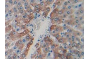 DAB staining on IHC-P; Samples: Rat Liver Tissue (CAPN1 抗体  (AA 75-356))