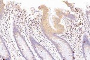 Immunohistochemistry analysis of paraffin-embedded human colon using,SUV3L1 (ABIN7075769) at dilution of 1: 1500 (SUPV3L1 抗体)