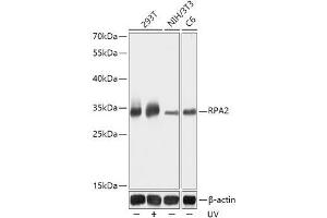 Western blot analysis of extracts of various cell lines using RPA2 Polyclonal Antibody at dilution of 1:1000. (RPA2 抗体)