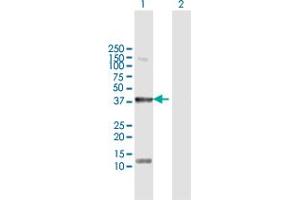 Western Blotting (WB) image for anti-serine/threonine/tyrosine Kinase 1 (STYK1) (AA 1-422) antibody (ABIN950094)