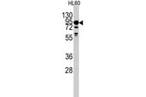 Western blot analysis of DYRK1A polyclonal antibody  in HL-60 cell line lysates (35 ug/lane). (DYRK1A 抗体  (Internal Region))