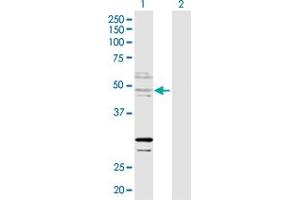 Western Blot analysis of ZNF277 expression in transfected 293T cell line by ZNF277 MaxPab polyclonal antibody. (ZNF277 抗体  (AA 1-438))