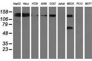 Western blot analysis of extracts (35 µg) from 9 different cell lines by using anti-L1CAM monoclonal antibody. (L1CAM 抗体)