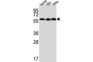 Western Blotting (WB) image for anti-UTP6, Small Subunit (SSU) Processome Component, Homolog (UTP6) antibody (ABIN3002297) (UTP6 抗体)