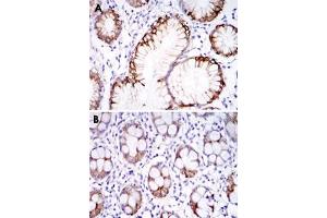 Immunohistochemical analysis of paraffin-embedded human stomach tissues (A) and colon tissues (B) using CA9 monoclonal antibody, clone 2D3  with DAB staining. (CA9 抗体)
