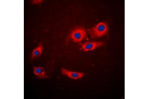 Immunofluorescent analysis of 4EBP1 staining in MCF7 cells. (eIF4EBP1 抗体  (N-Term))