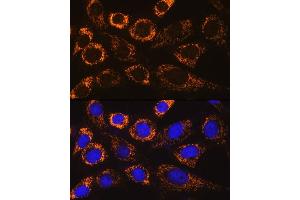 Immunofluorescence analysis of NIH/3T3 cells using P4H Rabbit pAb (ABIN6132886, ABIN6145137, ABIN6145138 and ABIN6217878) at dilution of 1:100. (P4HA3 抗体  (AA 20-110))