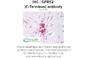Image no. 1 for anti-G Protein-Coupled Receptor 52 (GPR52) (C-Term), (Cytoplasmic Domain) antibody (ABIN1735119)