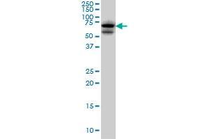 Western Blotting (WB) image for anti-A Kinase (PRKA) Anchor Protein 10 (AKAP10) (AA 1-101) antibody (ABIN599175) (AKAP10 抗体  (AA 1-101))