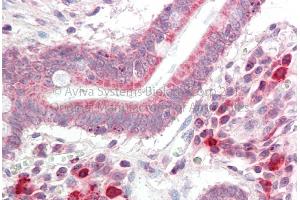 Rabbit Anti-NSMCE4A Antibody Catalog Number: ARP70964 Formalin Fixed Paraffin Embedded Tissue: Human Adult Small intestine  Observed Staining: Cytoplasm in hepatocytes Primary Antibody Concentration: 1:600 Secondary Antibody: Donkey anti-Rabbit-Cy3 Secondary Antibody Concentration: 1:200 Magnification: 20X Exposure Time: 0. (NSMCE4A 抗体  (C-Term))