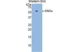 Western blot analysis of the recombinant protein. (Laminin beta 1 抗体  (AA 1053-1258))