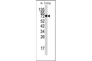 Image no. 1 for anti-Adenosine Monophosphate Deaminase 3 (AMPD3) (Middle Region) antibody (ABIN360232) (AMPD3 抗体  (Middle Region))