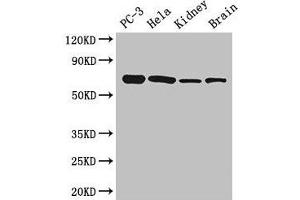 Western Blot Positive WB detected in: PC-3 whole cell lysate, Hela whole cell lysate, Mouse kidney tissue, Mouse brain tissue All lanes: GPI antibody at 2. (GPI 抗体  (AA 2-554))