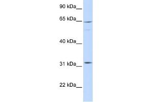 ARHGAP25 antibody used at 1 ug/ml to detect target protein. (ARHGAP25 抗体  (Middle Region))