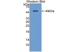Western Blotting (WB) image for anti-Interleukin 18 Receptor Accessory Protein (IL18RAP) (AA 310-451) antibody (ABIN1862748) (IL18RAP 抗体  (AA 310-451))
