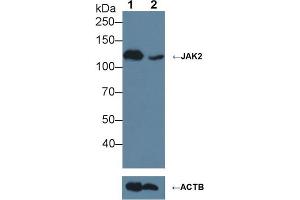 Knockout Varification: ;Lane 1: Wild-type Jurkat cell lysate; ;Lane 2: JAK2 knockout Jurkat cell lysate; ;Predicted MW: 130kDa ;Observed MW: 130kDa;Primary Ab: 3µg/ml Rabbit Anti-Human JAK2 Antibody;Second Ab: 0. (JAK2 抗体  (AA 508-800))