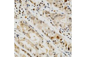 Immunohistochemistry of paraffin-embedded human stomach using CD274 antibody at dilution of 1:200 (x400 lens) (PD-L1 抗体)