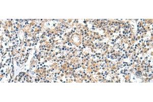 Immunohistochemistry of paraffin-embedded Human tonsil tissue using GEMIN7 Polyclonal Antibody at dilution of 1:50(x200) (GEMIN7 抗体)