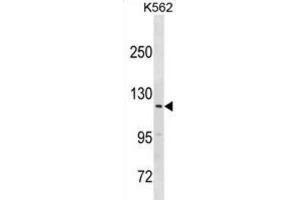 Western Blotting (WB) image for anti-Hect Domain and RLD 3 (HERC3) antibody (ABIN3000995) (HERC3 抗体)