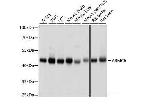 Western blot analysis of extracts of various cell lines using ARMC6 Polyclonal Antibody at dilution of 1:1000. (ARMC6 抗体)