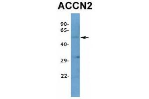 Host:  Rabbit  Target Name:  ACCN2  Sample Type:  Human Adult Placenta  Antibody Dilution:  1.