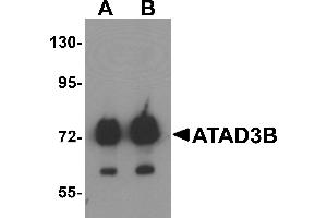 Western blot analysis of ATAD3B in human kidney tissue lysate with ATAD3B antibody at (A) 1 and (B) 2 µg/mL . (ATAD3B 抗体  (C-Term))
