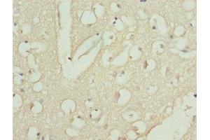 Immunohistochemistry of paraffin-embedded human brain tissue using ABIN7146436 at dilution of 1:100 (CAMK1D 抗体  (AA 1-180))