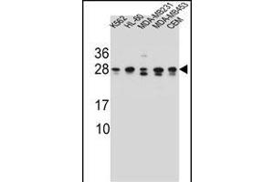 RAB3D Antibody (C-term) (ABIN657140 and ABIN2846278) western blot analysis in K562,HL-60,MDA-M,MDA-M,CEM cell line lysates (35 μg/lane). (RAB3D 抗体  (C-Term))