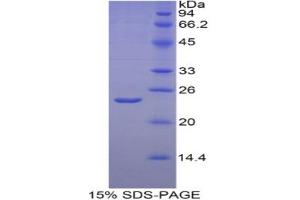 SDS-PAGE analysis of Human HIF2a Protein.