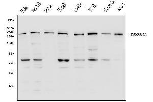 Western blot analysis of DROSHA using anti-DROSHA antibody (ABIN7602279).