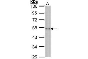 WB Image Sample (30 ug of whole cell lysate) A: Hela 10% SDS PAGE antibody diluted at 1:1000 (CTBP1 抗体  (Center))