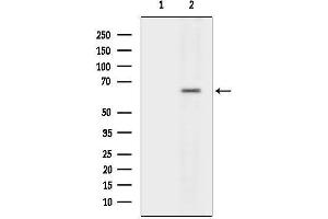 anti-Potassium Channel, Subfamily V, Member 2 (KCNV2) (N-Term) antibody