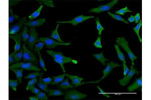 Immunofluorescence of monoclonal antibody to SF3B2 on HeLa cell. (SF3B2 抗体  (AA 1-636))
