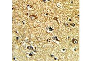 IHC analysis of FFPE human brain tissue with TH antibody (Tyrosine Hydroxylase 抗体  (AA 486-514))