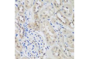 Immunohistochemistry of paraffin-embedded rat kidney using UBE3A antibody at dilution of 1:200 (40x lens). (ube3a 抗体)