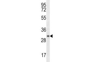 Myogenin antibody western blot analysis in ZR-75-1 lysate. (Myogenin 抗体  (AA 1-30))