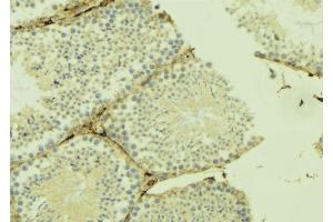 ABIN6274911 at 1/100 staining Mouse testis tissue by IHC-P. (B4GALT3 抗体  (Internal Region))