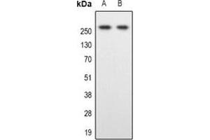 Western blot analysis of SPTBN1 expression in Hela (A), Colo205 (B) whole cell lysates. (SPTBN1 抗体)
