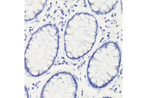Immunohistochemistry of paraffin-embedded mouse stomach using GAPDH Mouse mAb (ABIN3020540, ABIN3020541, ABIN3020542 and ABIN1512934) at dilution of 1:100 (40x lens). (GAPDH 抗体)