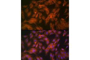 Immunofluorescence analysis of C6 cells using Calpain 1 Rabbit mAb (ABIN7266033) at dilution of 1:100 (40x lens). (CAPNL1 抗体)