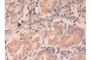 DAB staining on IHC-P; Samples: Human Stomach Tissue (RNASE11 抗体  (AA 18-199))